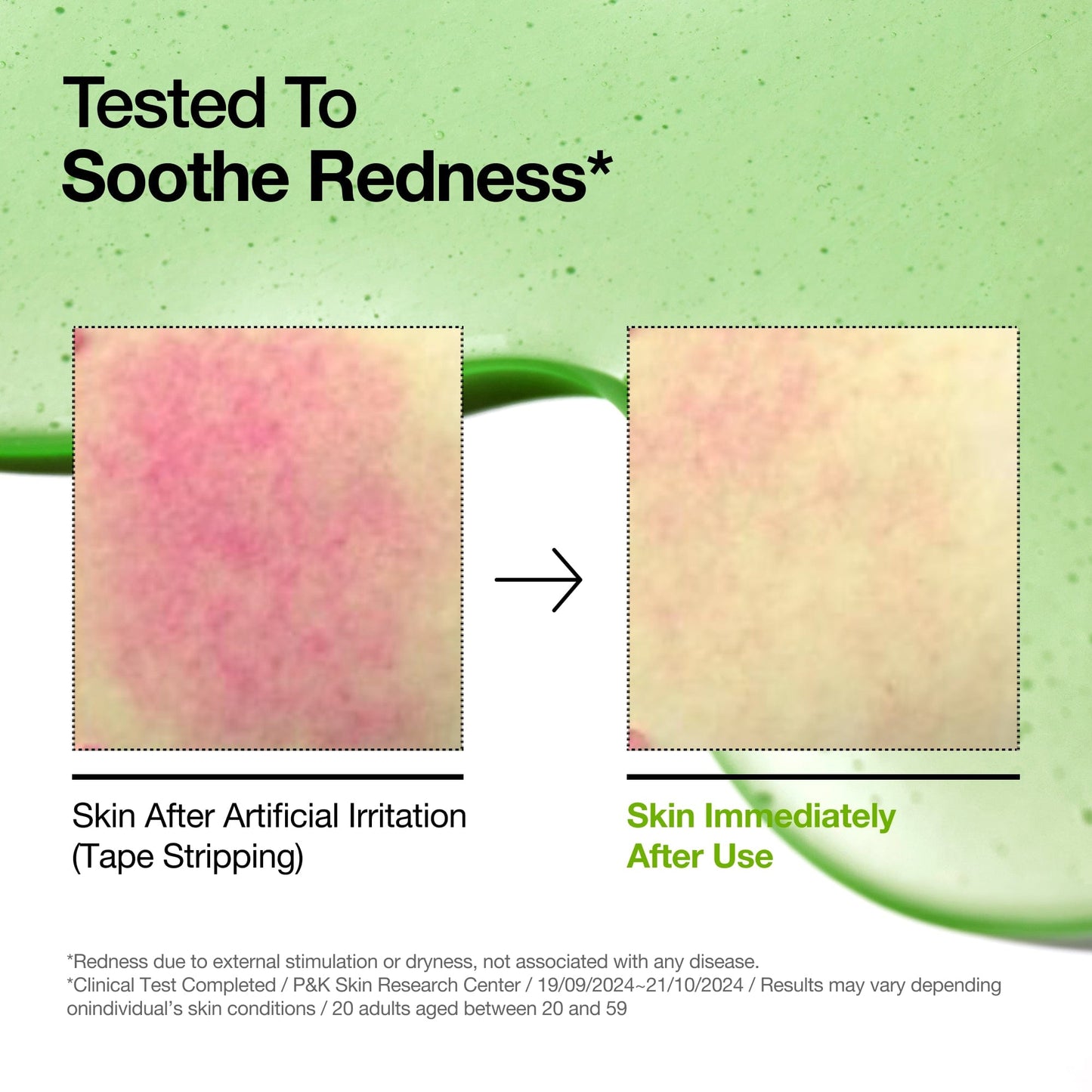 Azelaic Acid 10 Hyaluron Redness Soothing Serum - Lumiso