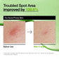 Azelaic Acid 10 Hyaluron Redness Soothing Serum - Lumiso