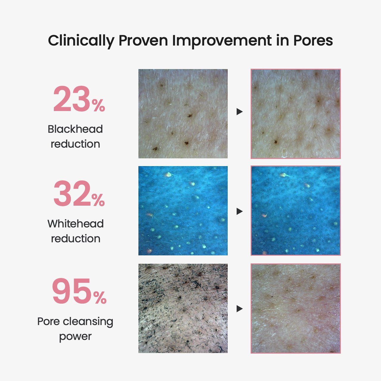 Collagen Cleansing Oil - Lumiso