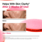Niacinamide 10 TXA 4 Serum for Brightening and Dark Spots - Lumiso