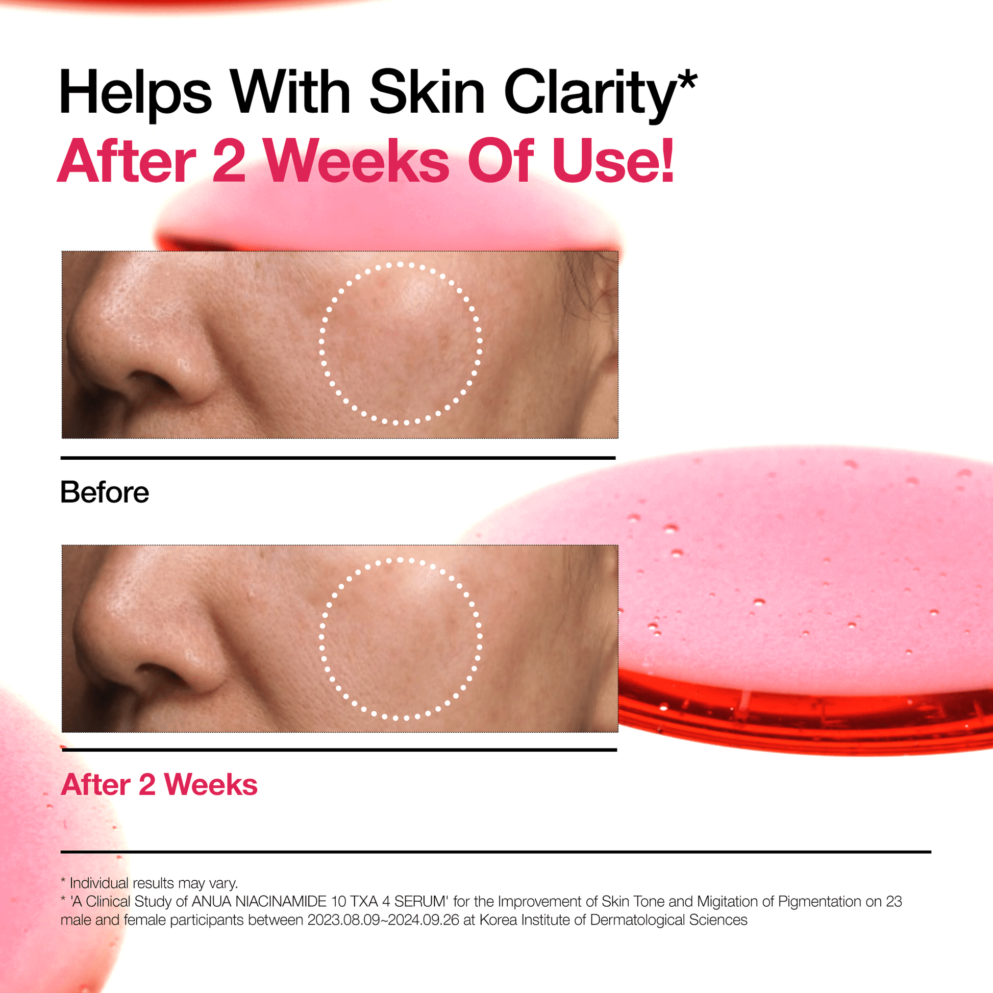 Niacinamide 10 TXA 4 Serum for Brightening and Dark Spots - Lumiso